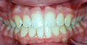 cases14