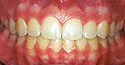 cases5