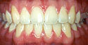 cases6