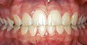 cases7