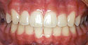 cases8