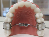 Expander_12Mar2015