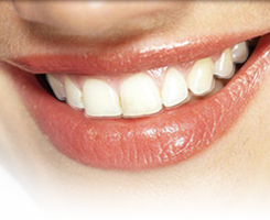 Clear Aligners